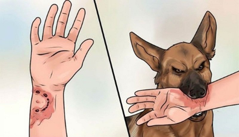 Chó bị bệnh dại cắn người rất nguy hiểm